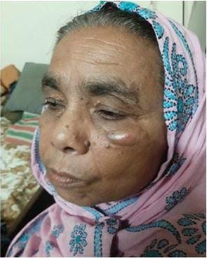 মিঠাপুকুরে অটোতে ঢিল ছোড়ার প্রতিবাদ করায় ২ নারীকে বেদম মারপিটে রক্তাক্ত জখম