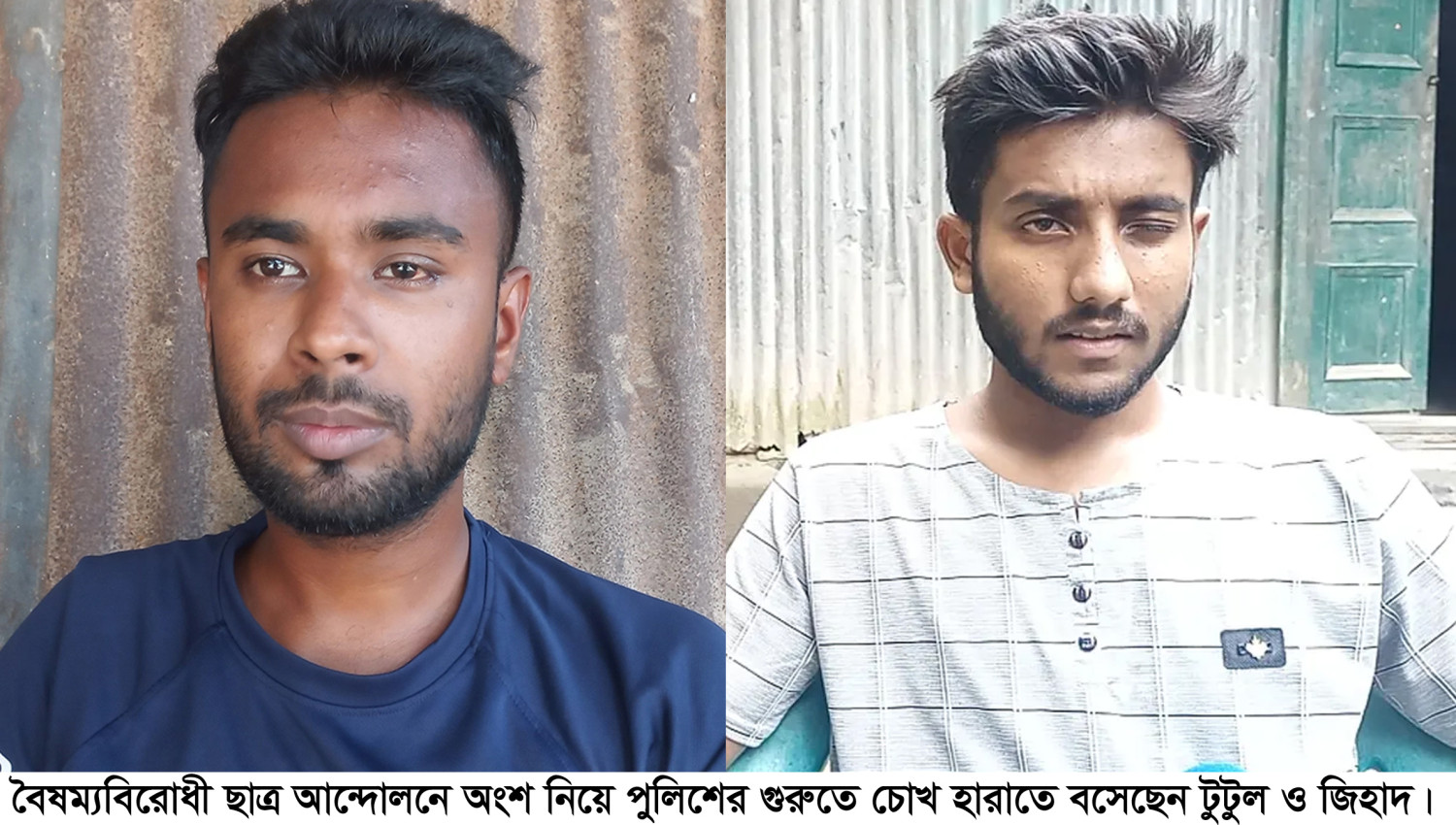 ছাত্র আন্দোলনে পুলিশের গুলিতে চোখ হারাতে বসেছেন টুটুল ও জিহাদ